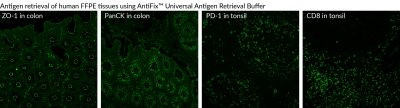 AntiFix™ Universal Antigen Retrieval Buffer, 10X