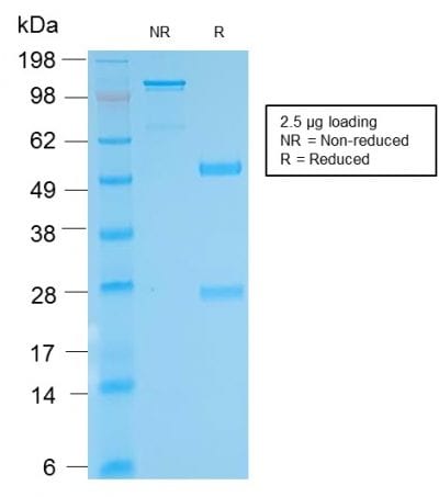 Biotin Recombinant Monoclonal Rabbit Antibody (BTN/2032R)
